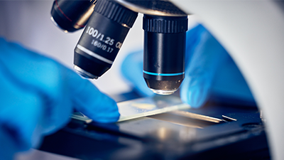 INO Services Sciences de la vie Développement de modules d’illumination et détection pour microscopie avancée Thumbnail